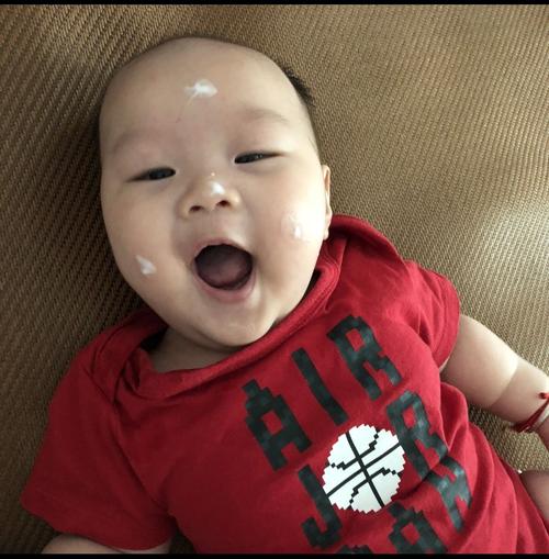 为什么宝宝的湿疹反反复复,宝宝湿疹为什么总是反反复复