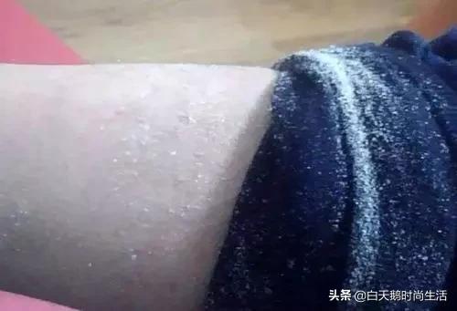 拯救干皮和鸡皮的身体乳,拯救干皮的身体乳