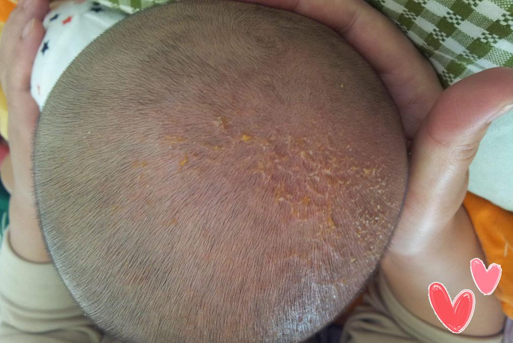 生下来丑宝宝怎么办,刚生出来的宝宝真丑