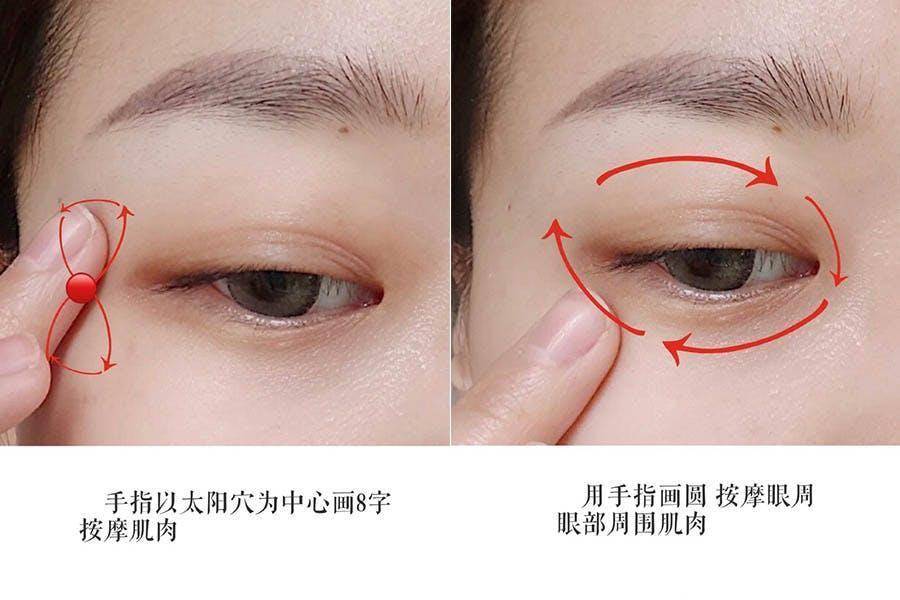 眼周水肿的原因分析,如何改善眼皮浮肿