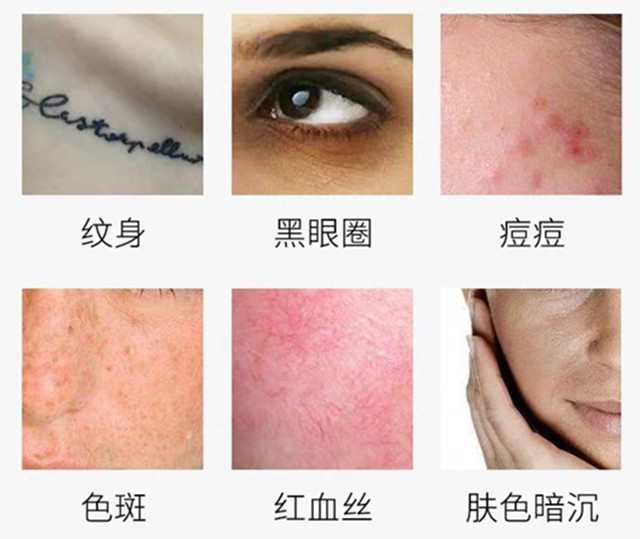 适合遮毛孔的遮瑕,黑皮好用的遮瑕