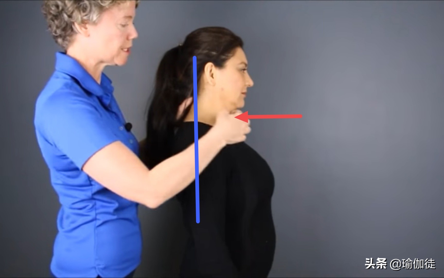 颈椎富贵包怎么消除最有效方法,怎样快速消除颈椎的富贵包