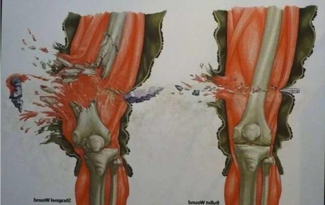 中弹后会失去意识吗,士兵中弹还能战斗吗