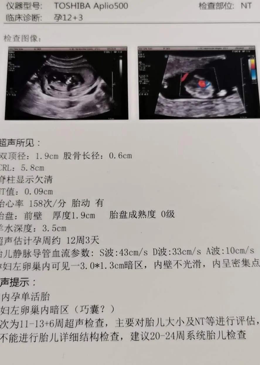 中医调理不孕多久能怀上,不孕十年了突然怀孕