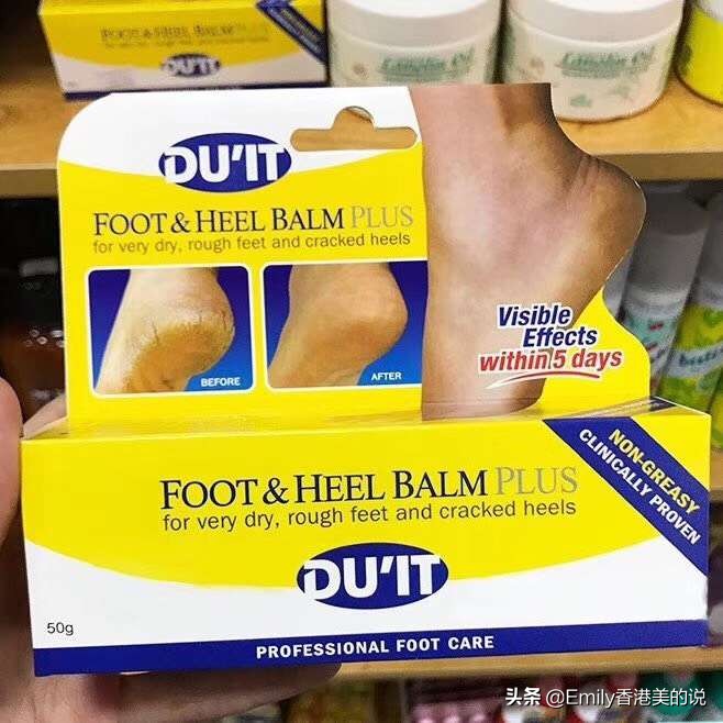 冬天手干手裂怎么回事用什么药,冬天手干开裂擦什么最好