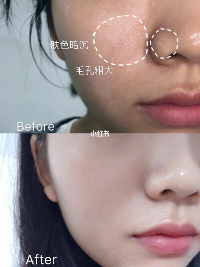 改善暗沉提亮肤色精华液,去暗黄补水精华提亮肤色