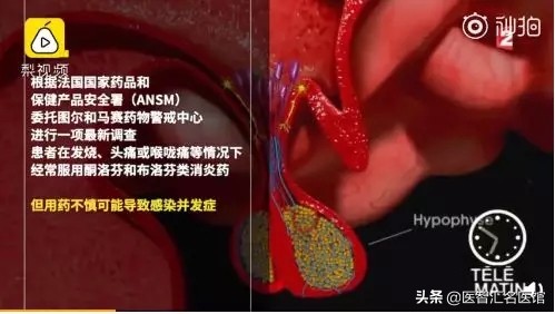 布洛芬真的有那么可怕吗,布洛芬可怕后果