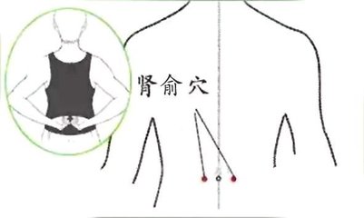 脚后跟鱼鳞状干裂怎么治疗,脚后跟像鱼鳞一样一层层干裂中医