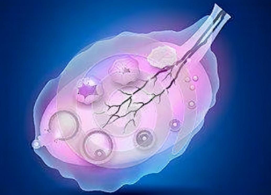 30-50岁经产妇“闻风色变”的疾病,文献记载发病率高达10%-65%