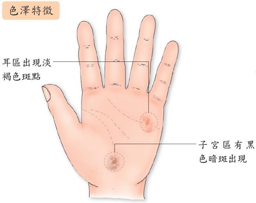 子宫肌瘤手相,子宫肌瘤的反射区手上