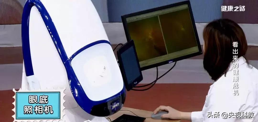 眼底照相全过程,拍一张眼睛的照片