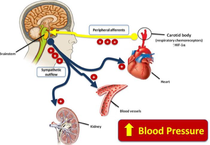高血压为何那么难被治愈,高血压的人血压降下来是什么原因
