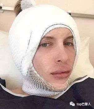 法国情侣豪掷200万,经历15次手术,只为成芭比与肯尼