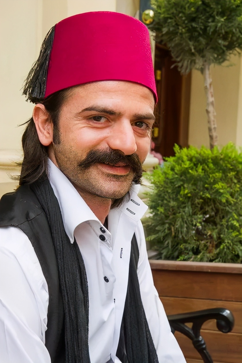 中国人植发,植发的外国人