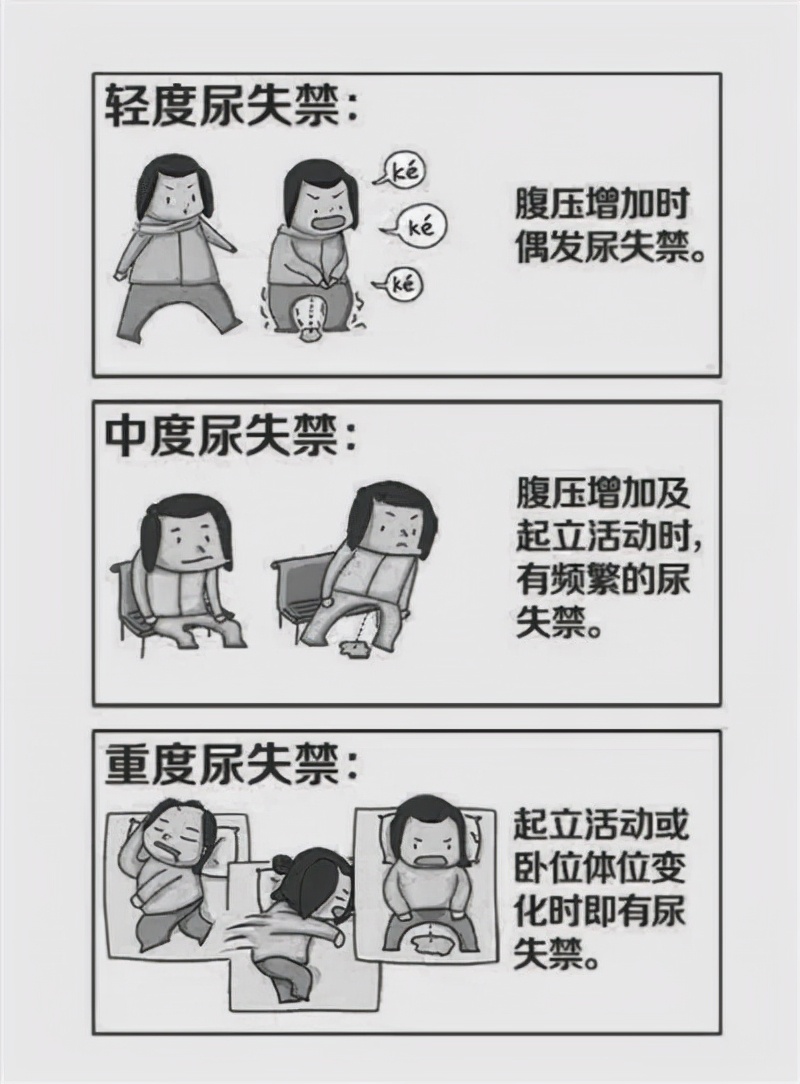 盆底康复凯格尔运动,盆底康复操视频教程