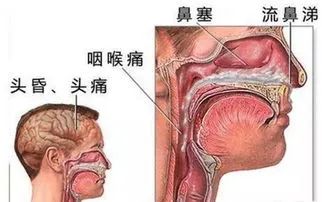 南阳医专一附院耳鼻喉科,南阳医专一附院耳鼻喉科主任