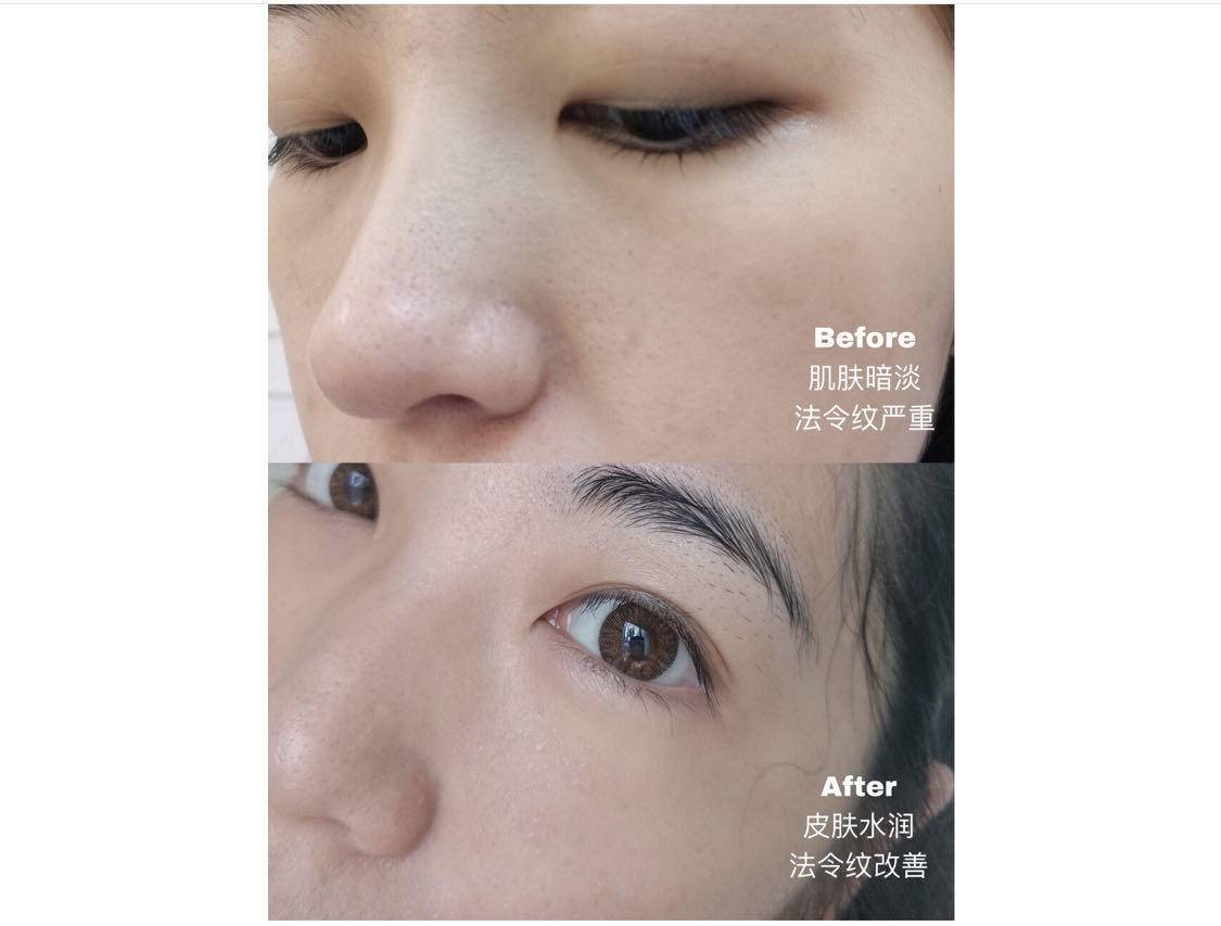 618囤什么护肤品,618值得买的几款护肤单品