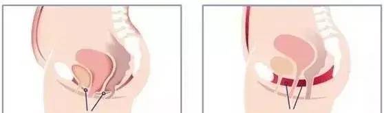 女人生产后的崩溃,女人分娩三大尴尬事情