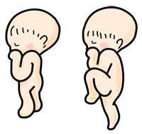 臀位有多大概率可以顺产,臀位能顺产的几率