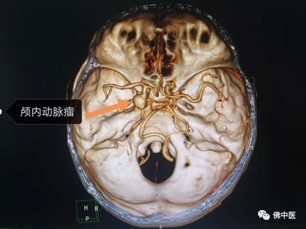 警惕熬夜,注意别仗着年轻就透支自己的身体