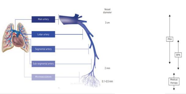 血栓高血压的症状和治疗,慢性肺血栓栓塞性肺动脉高压预后