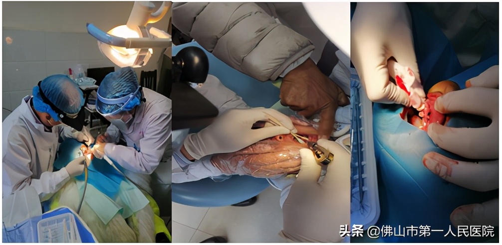 佛山对口帮扶凉山,佛山对口帮扶助力凉山脱贫攻坚