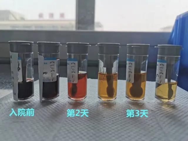 三岁小孩高烧过后全身红点点,3岁宝宝高烧39.5度不退脚冰凉
