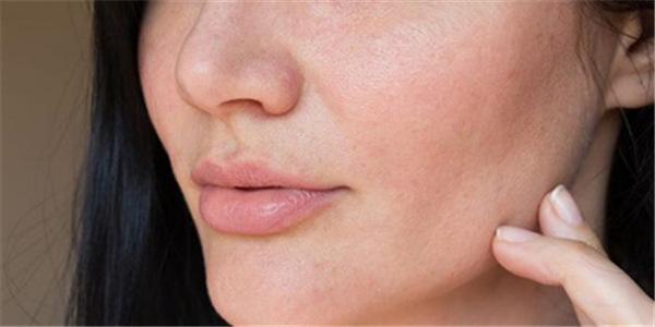 脸又痒又红又起痘,敏感皮肤脸发红发烫怎么办