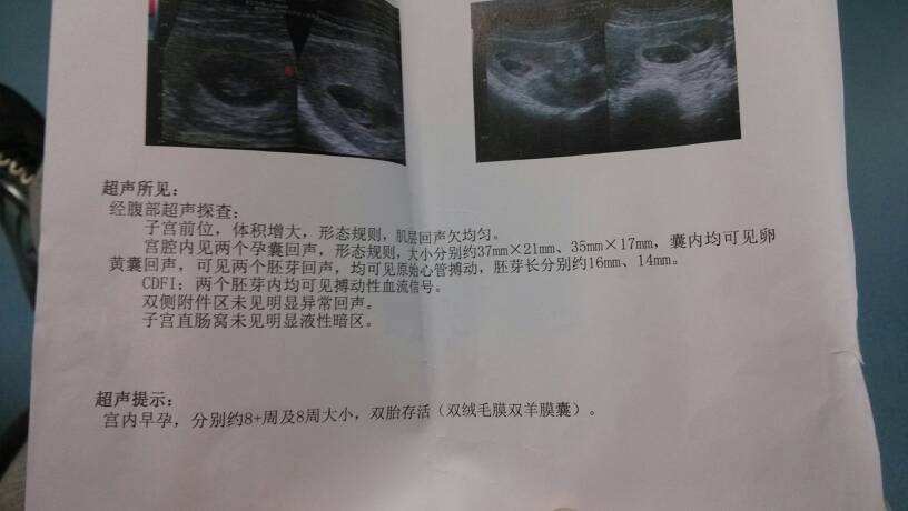 流产的胎儿是活的怎么处理,医院如何知道自己的流产情况