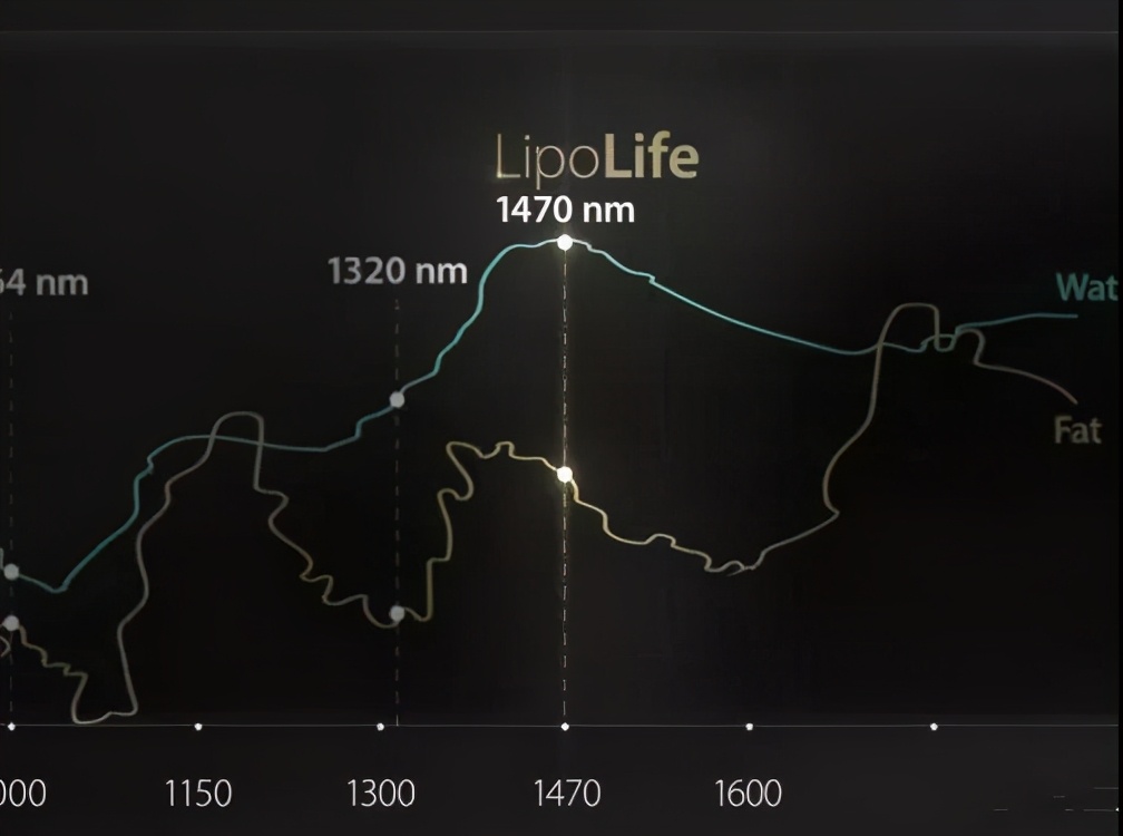 飞顿激光5g吸脂有效果吗,飞顿5号祛斑
