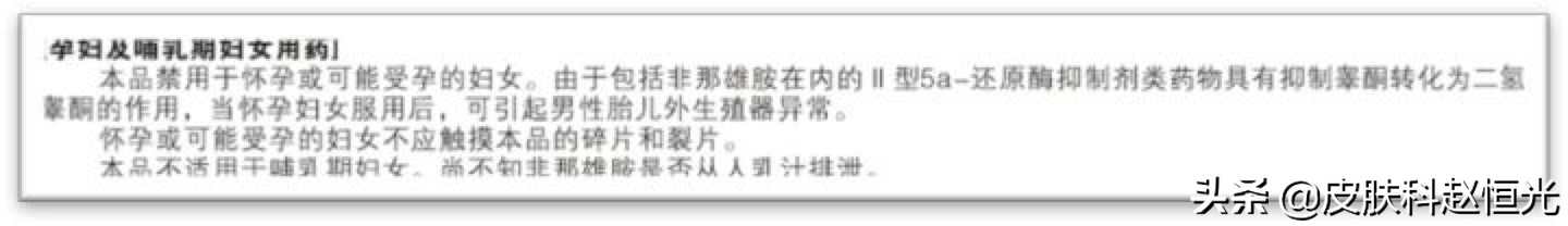 女性雄激素性脱发（脂溢性脱发）的常用治疗药物有哪些？