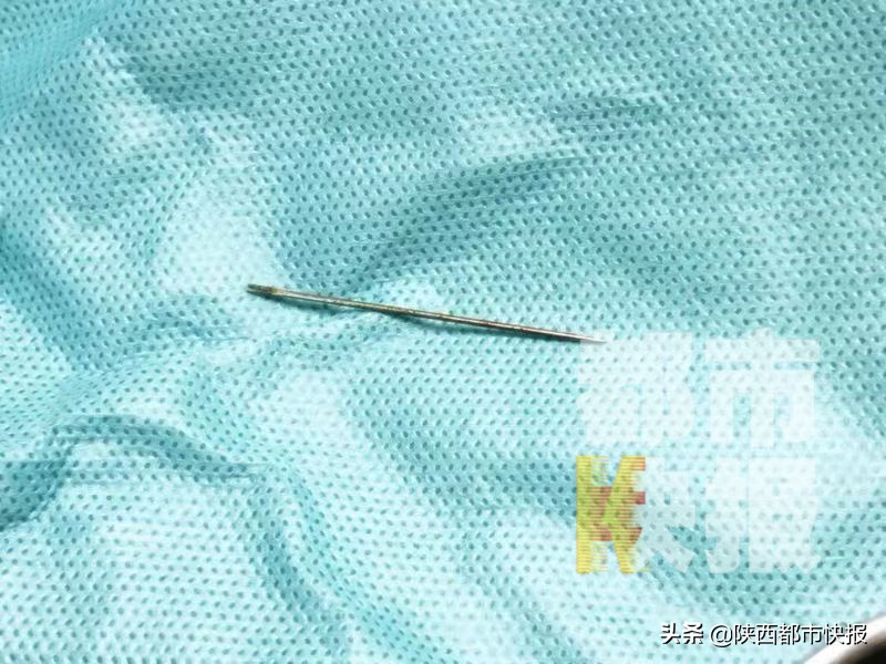 老人胳膊上有鼓包,老人胳膊起包了怎么回事