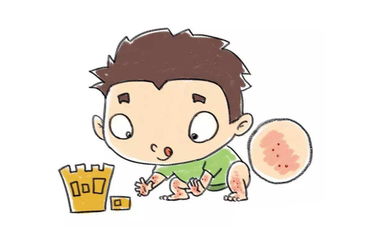 儿科微诊室：肚子大/枕秃/生理性体重下降/沙土性皮炎/大便奶瓣/眼睛红