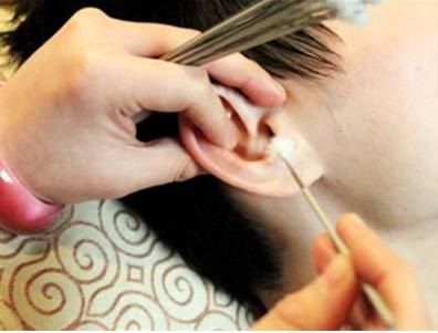 采耳到底能不能掏出耳屎,小美被感染了会怎么样