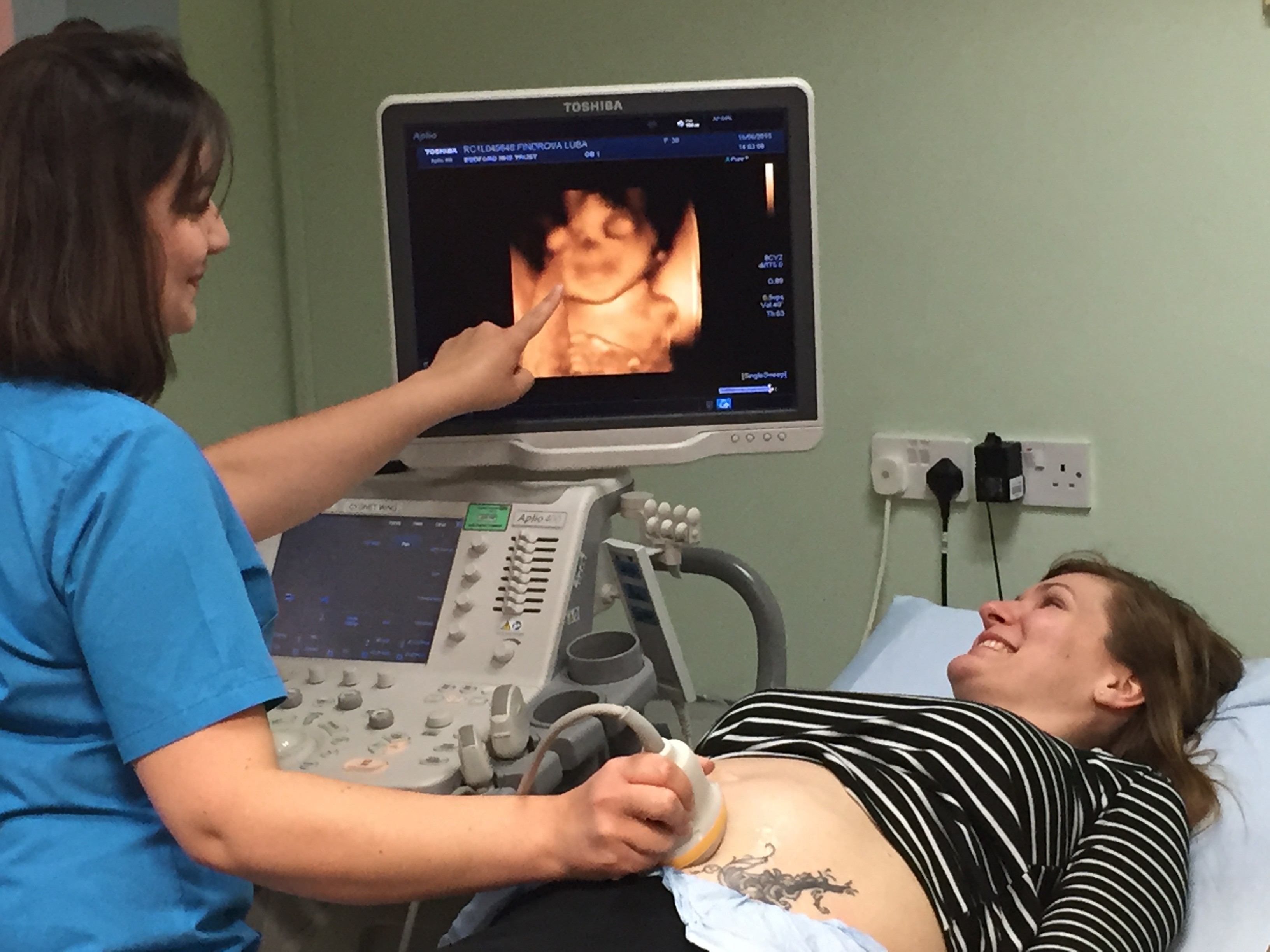 胎儿四维看哪几个指标,孕期做四维宝宝能看清楚吗