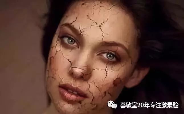 激素脸敏感专用护肤品,激素脸护肤品推荐排行