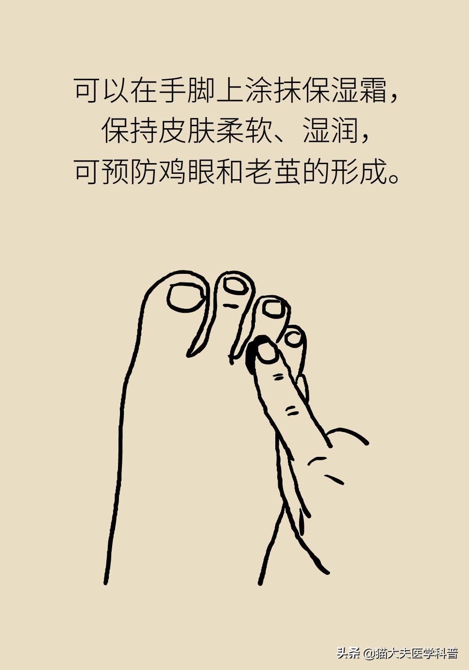 鸡眼好了长了一层老茧,鸡眼与老茧的区别图片