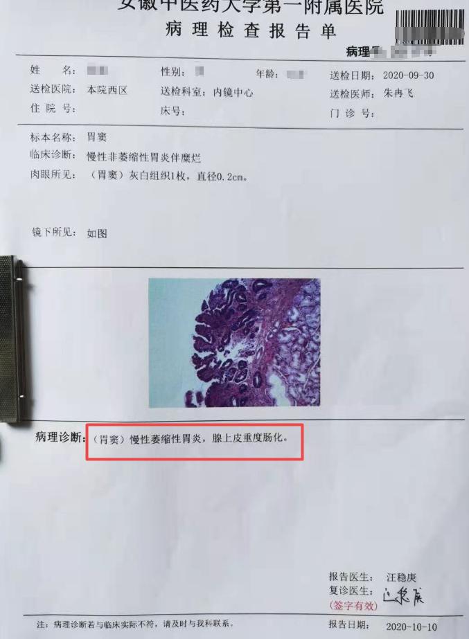 治疗重度肠上皮化生用什么药,30多岁得了肠化生还能治好吗