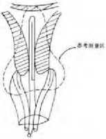 什么是近距离交叉口,什么是近距离用眼时间