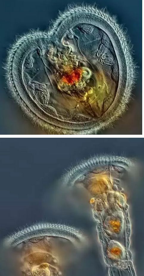 水产镜检虫图片,水产养殖常见虫类图