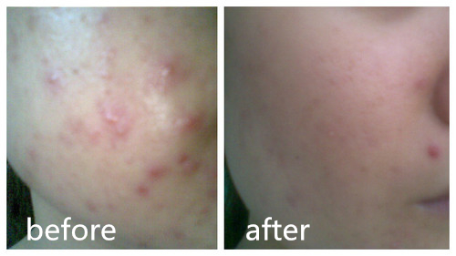 卸妆怎么才能卸干净呢,卸妆没卸干净怎么补救