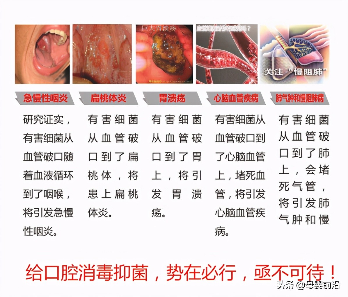 儿童牙膏6-12岁智商税,儿童牙膏智商税少的是哪个品牌