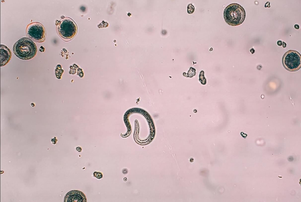 寄生虫感染的疾病都有哪些,妇科寄生虫有哪些