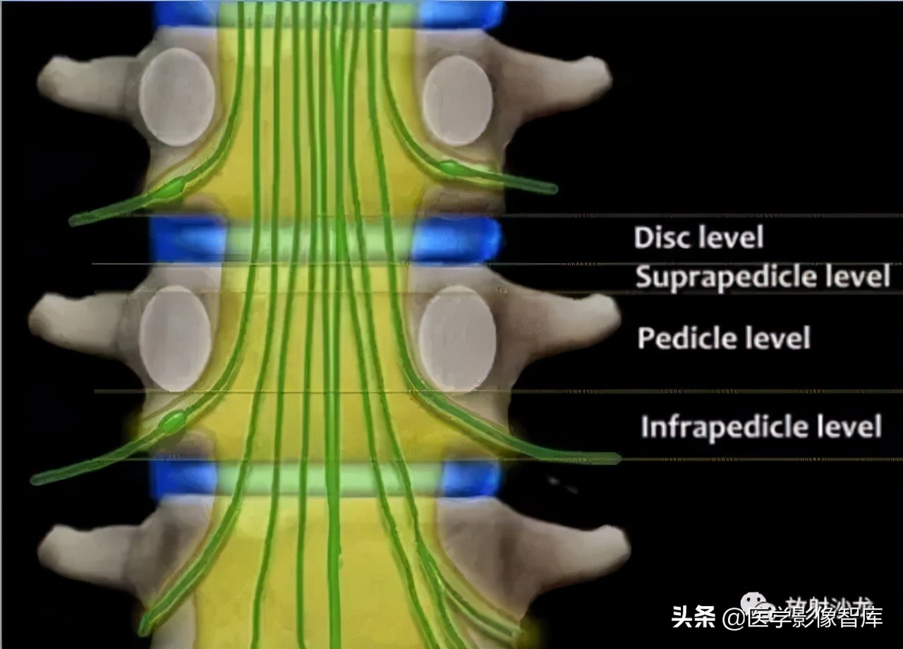 一键收藏所有的内容,颈椎间盘病变的症状和治疗