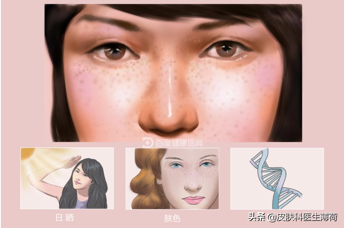 看图识疹子,如何快速辨认各种斑