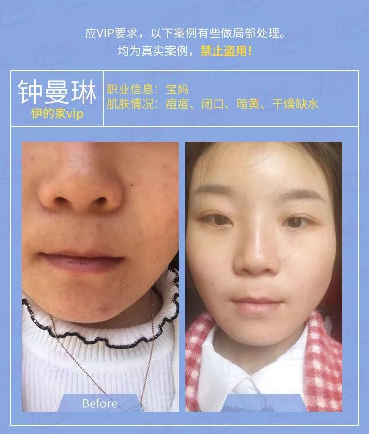 在成长的过程中，你是否也曾对自己的颜值不满意？