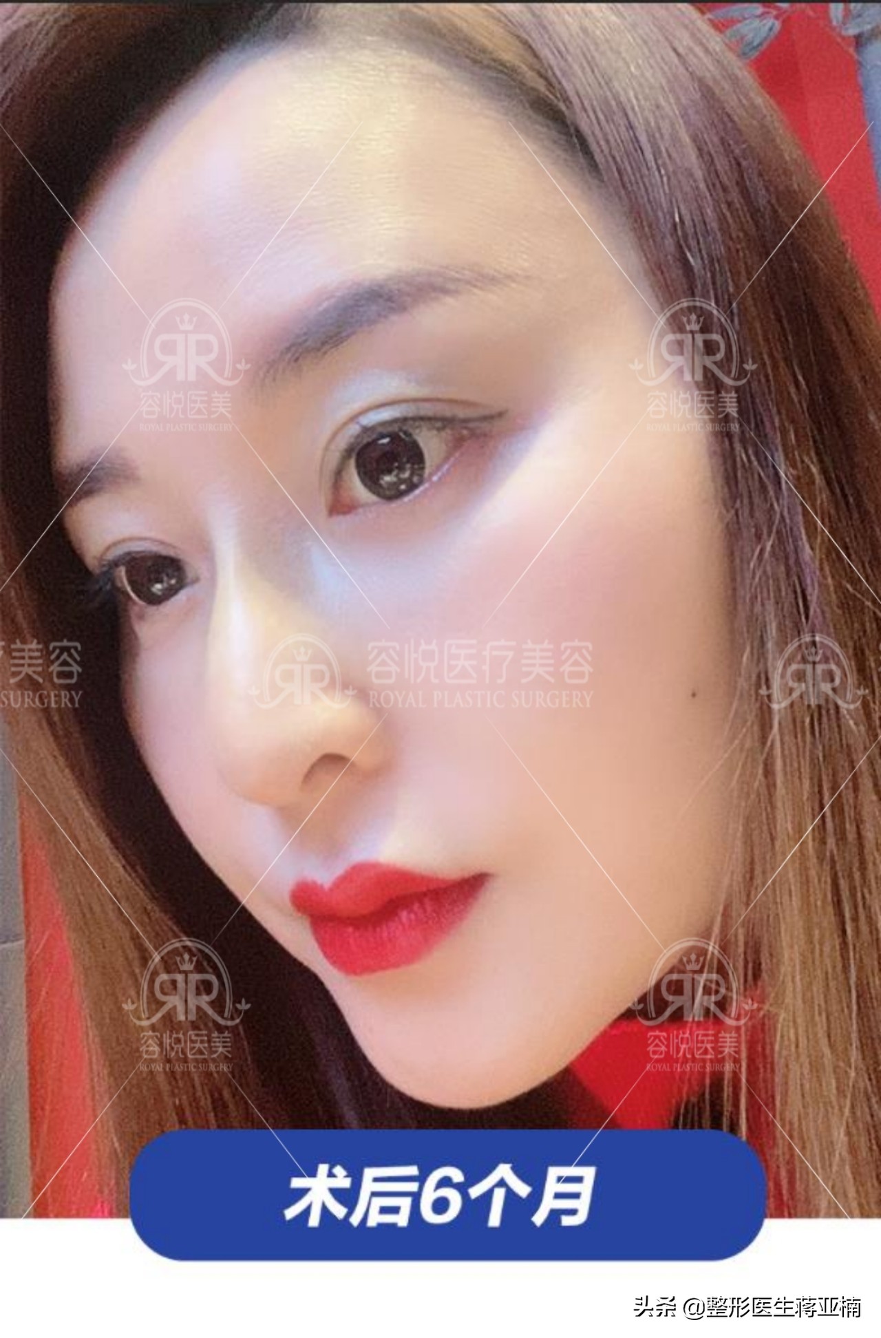 蒋亚楠整形医生照片,医疗美容医生蒋亚楠