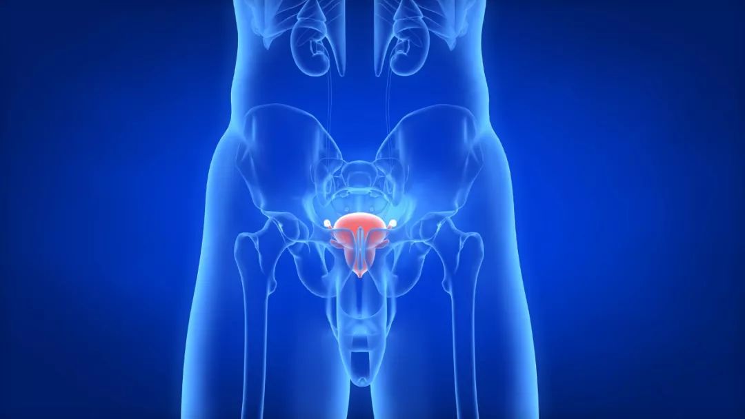 90%的晚期前列腺癌都会发生骨转移，内分泌治疗是首选