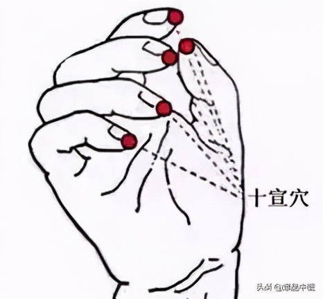 中医经络平衡介入疗法,经络是如何调节人体阴阳平衡的