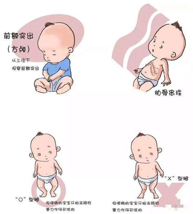 诺爱诺儿：给宝宝补维生素D，你确定补对了？